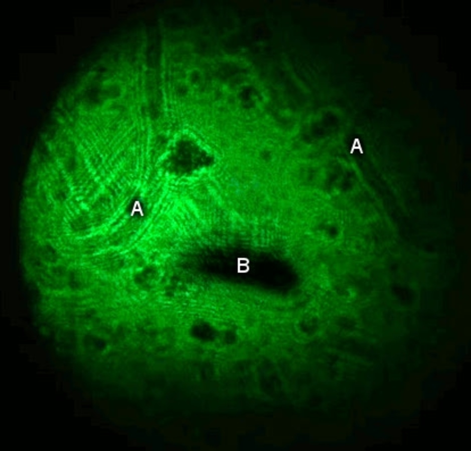 Ilustracja do artykułu "Laserowy mikroskop"